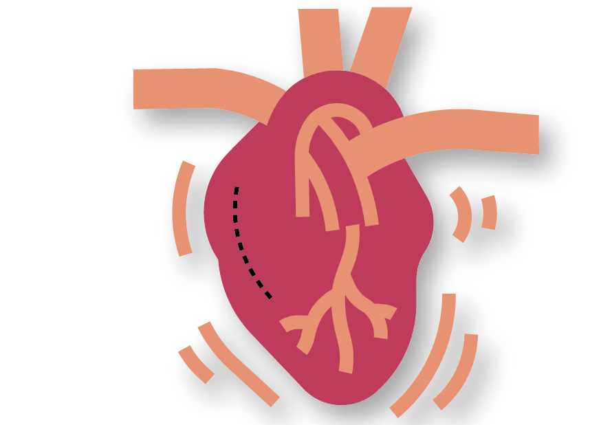 Spesialis Bedah Thoraks Kardio Vaskuler